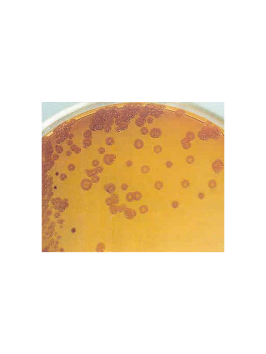 門(mén)多薩假單胞菌